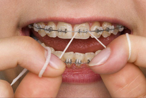 انواع نخ دندان